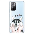 Coque Xiaomi Redmi Note 11 Pro/Note 11 Pro+ en TPU IMD - Smile